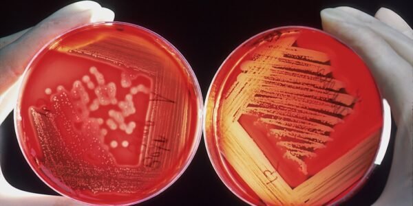 Descubren bacterias intestinales clave para la salud óptima